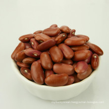 China Best Selling Small red kidney beans For Sales